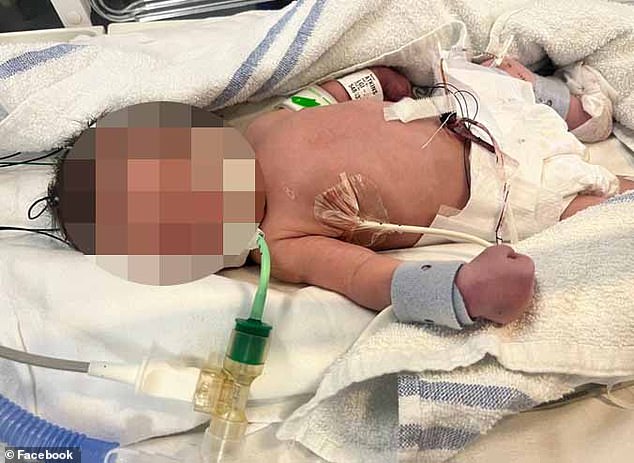 Bayi ajaib Nyonya Atkinson (foto) memiliki berat 4 pon saat lahir. Keluarga menamainya Posie. Dia sekarang makan dengan baik dan mengejutkan dokter dengan kemajuannya, kata keluarga