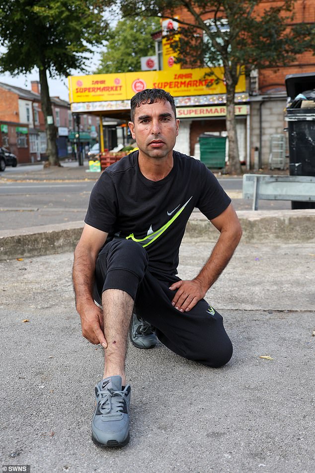 Dalam foto: Yousef Ahmadzai yang mencoba mengalihkan perhatian anjing tersebut dan kakinya digigit. Anjing itu ditempatkan di kandang yang aman setelah ditangkap oleh Polisi West Midlands dan dibawa ke dokter hewan setempat karena kelelahan akibat panas.